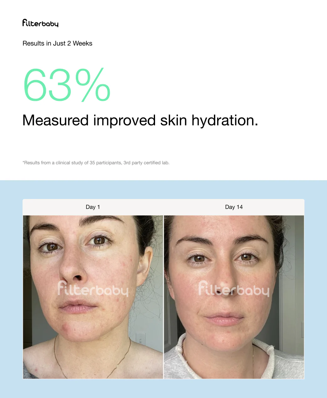 Get Filterbaby Skincare Filter 2.0 - Try Now - Image 29